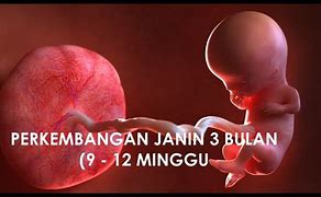 Bentuk Bayi Usia 3 Bulan